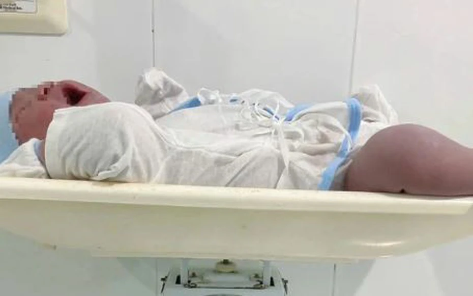 Bé trai nặng 5,8 kg chào đời ở Cà Mau