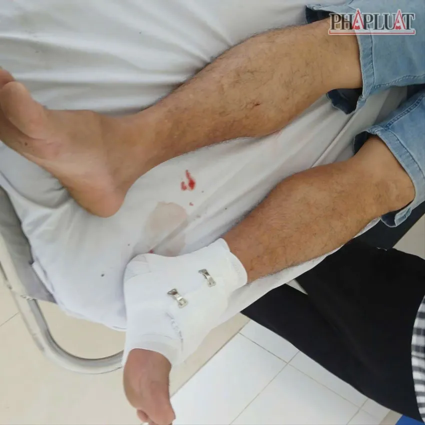 Thầy giáo bị cá sấu xổng chuồng cắn vào chân ở Tây Ninh