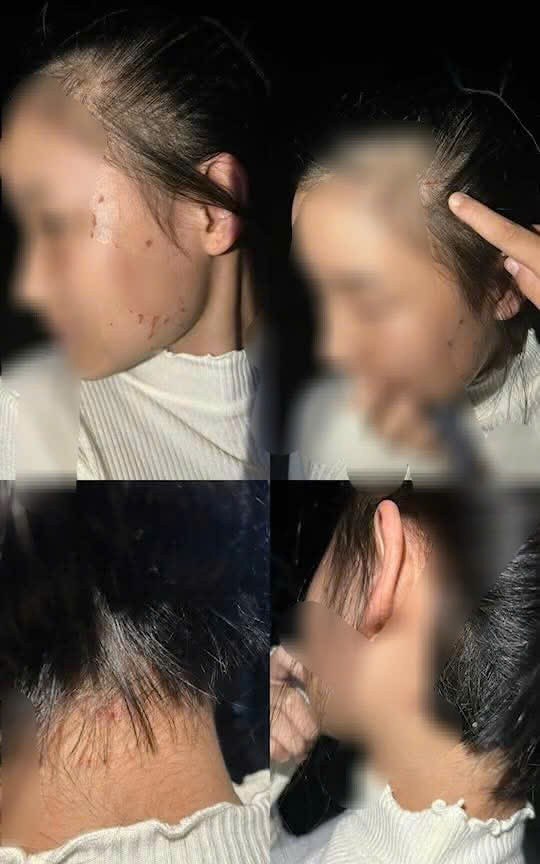 [CLIP] Công an vào cuộc vụ nữ sinh lớp 10 Trường THPT Lương Thế Vinh bị đánh hội đồng