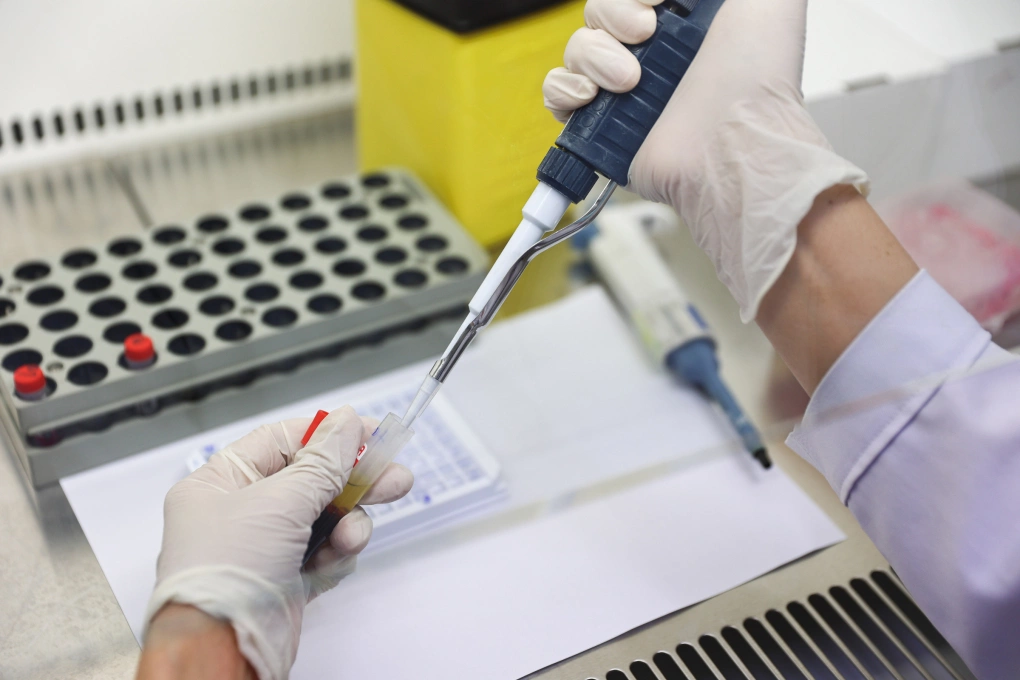 Nhóm 15-29 tuổi chiếm gần nửa số ca HIV mới tại TP HCM