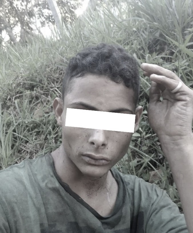 Kỳ tích Brazil: Hy hữu nhưng có thật ! Thanh niên 18t bị cư/ớ/p chém gần lìa c/ổ ! vẫn đi bộ 500 tiềm sự giúp đỡ