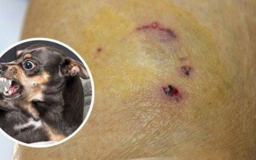 Lào Cai: 4 người trong gia đình bị chó cắn, 1 người tử vong nghi do dại