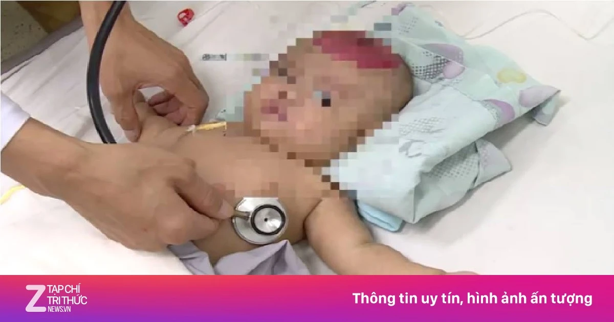 Em bé 2 tháng tuổi chấn thương sọ não vì điện thoại rơi vào đầu