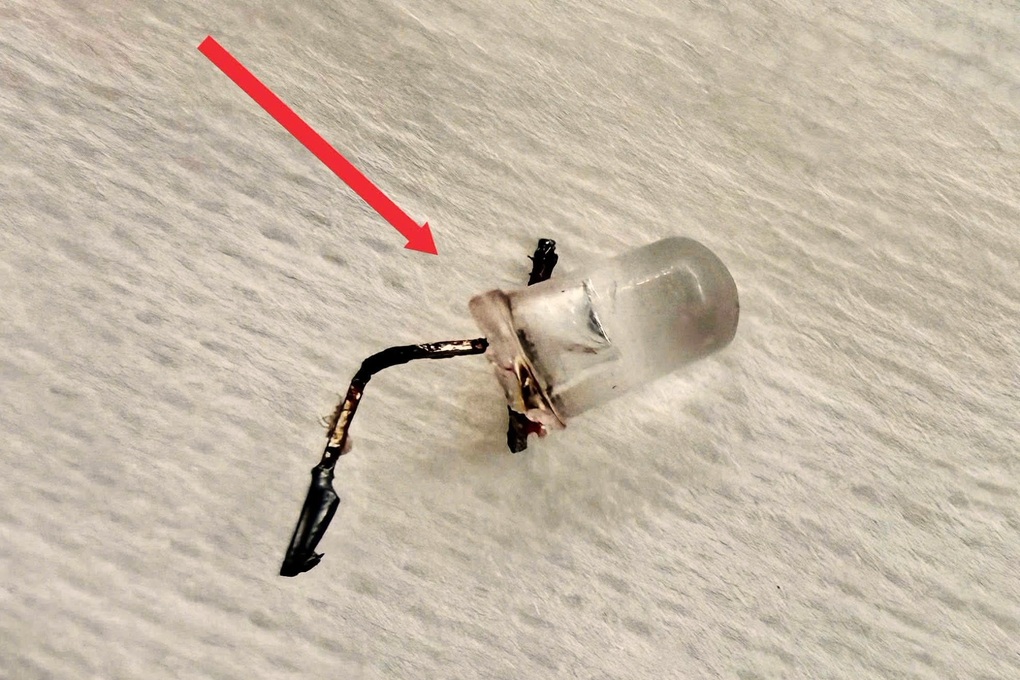 TPHCM: Bé gái 9 tháng tuổi nuốt bóng đèn LED, nhập viện nguy kịch - 2