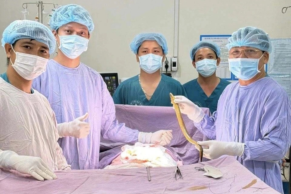 Phẫu thuật lấy con lươn dài 50cm, chui đường hậu môn vào bụng của bệnh nhân - 1