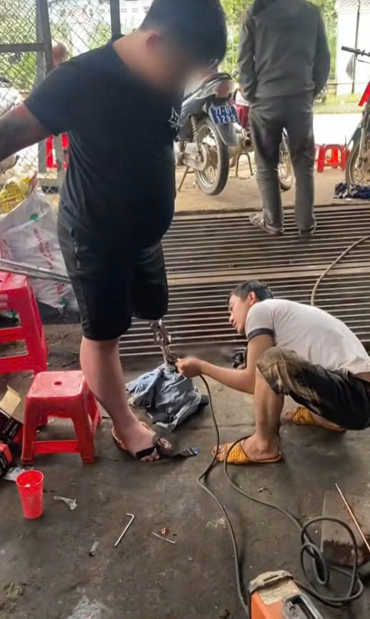 Ca “phẫu thuật” chỉ có ở Việt Nam: Lần đầu tiên thấy cảnh gãy chân vào xưởng cơ khí chứ không phải bệnh viện